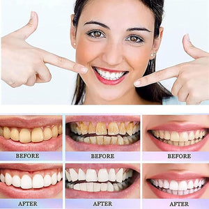 Oralhoe - Nicotinamide Dazzle White Toothpaste